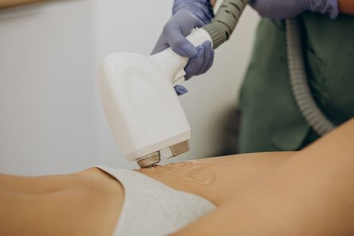 Depilação Laser Corpo Inteiro Mulher